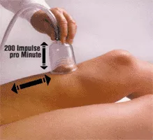 Schröpfmassage